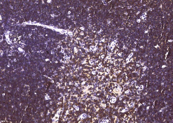 CD6/Cluster of Differentiation 6 Monoclonal Antibody-searchlist-1
