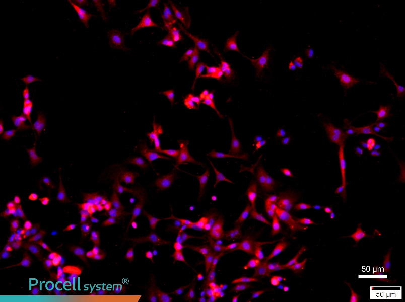 Mouse Type II Alveolar Epithelial Cell Complete Medium - 1