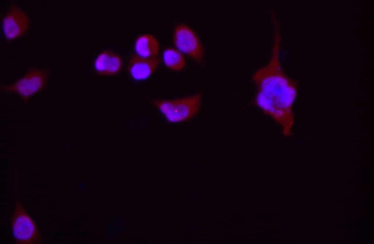 beta actin Monoclonal Antibody - 2