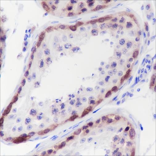 Recombinant CTAG1B Monoclonal Antibody-searchlist-1