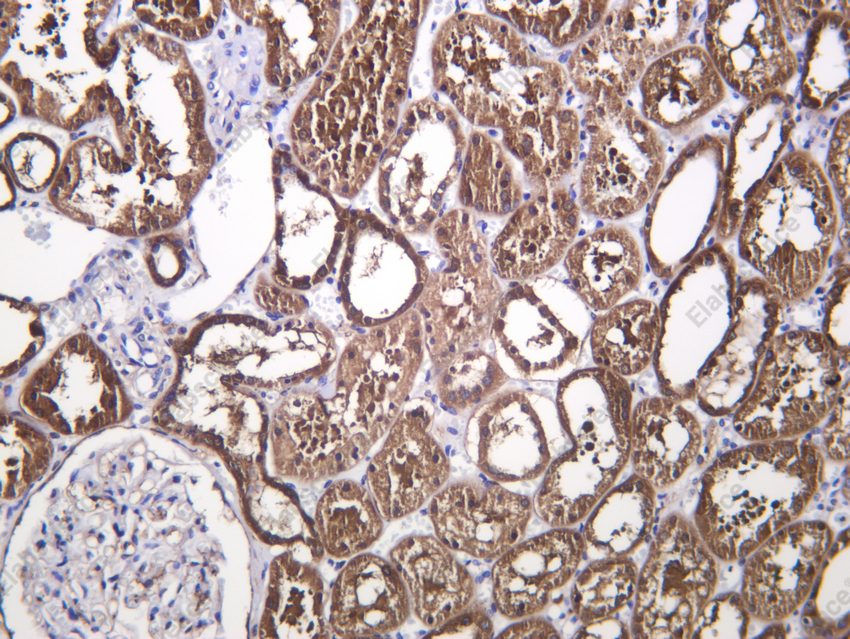 Recombinant GLUT2 Monoclonal Antibody - 2