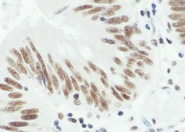 Recombinant U2AF2 Monoclonal Antibody-searchlist-2