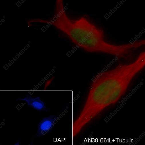 Recombinant SOX11 Monoclonal Antibody - 3
