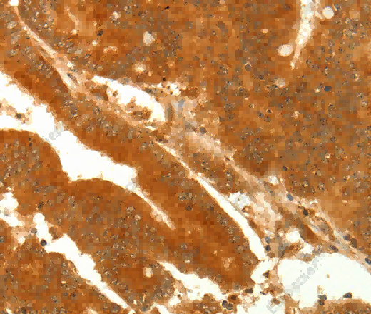 NAPA Polyclonal Antibody - 2