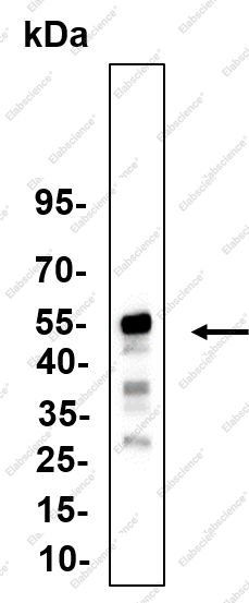 Recombinant EMMPRIN Monoclonal Antibody - 1