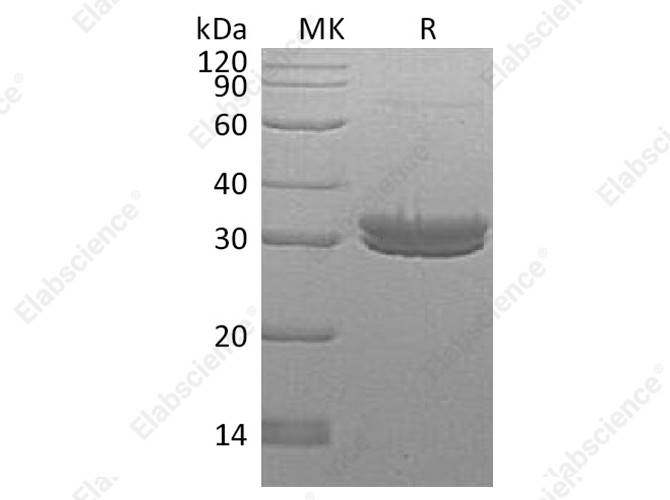 Recombinant Human Kallikrein 7/KLK7 Protein (His Tag) - 1