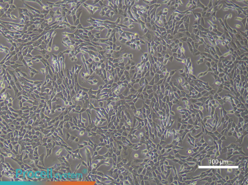 Mouse Pulmonary Artery Endothelial Cells (Primary cell immortalization)Mouse Pulmonary Artery Endothelial Cells (Primary cell immortalization) - 3
