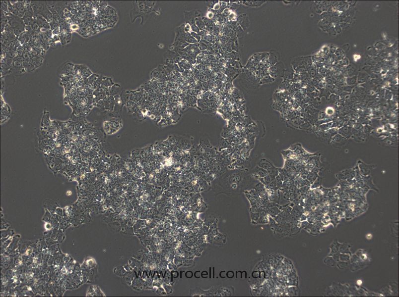 NCI-H2170（人肺鳞癌细胞）-细胞系-武汉普诺赛生命科技有限公司