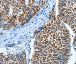 ALDH4A1 Polyclonal Antibody - 3