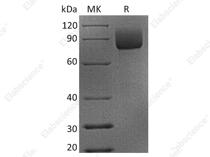 Recombinant Rhesus macaque CD19 Protein (Fc Tag) - 1