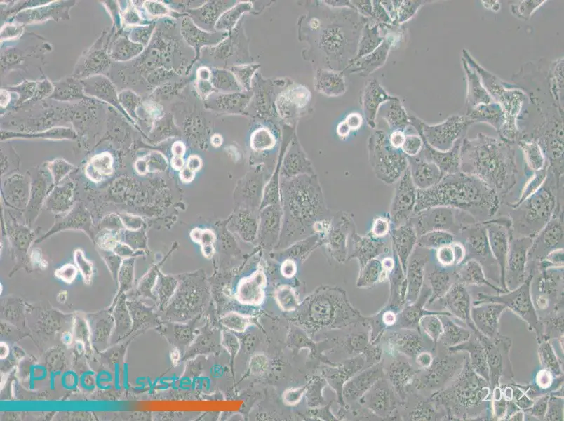 Anglne Cell Complete Medium - small - 4