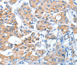 AUP1 Polyclonal Antibody - 3