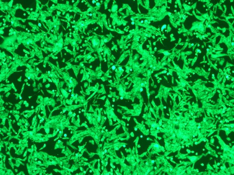 NCI-H446-GFP Cell Complete Medium - 3