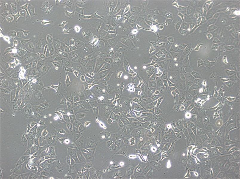 NCI-H1693 Cell Complete Medium - 2