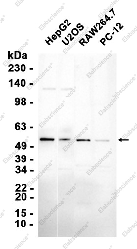 Recombinant KLF10 Monoclonal Antibody - 2