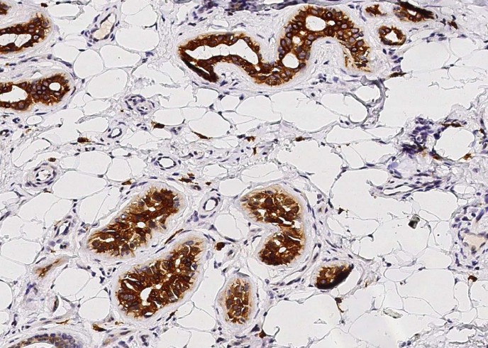 Recombinant c-Kit/CD117 Monoclonal Antibody-searchlist-1