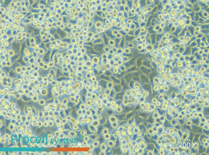 NCI-H2122 Cell Complete Medium - 5