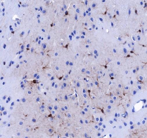 Recombinant FABP7 Monoclonal Antibody - small - 3