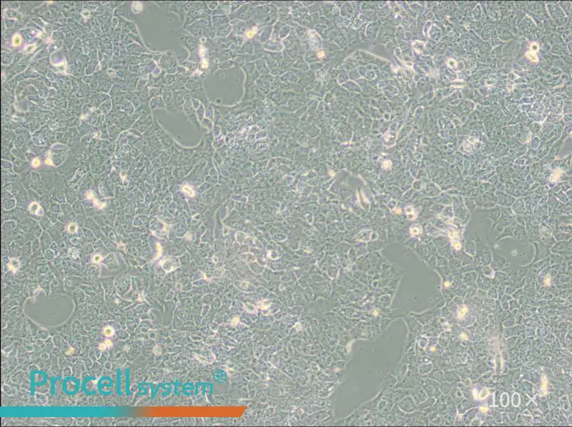 NCI-H2228 [H2228; H-2228] Cell Complete Medium - 1