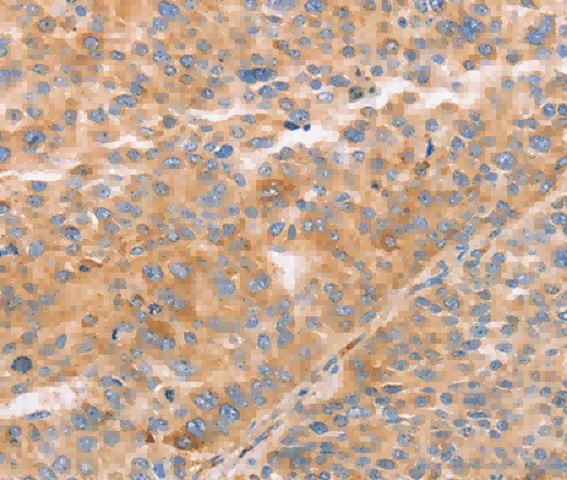 STK4 Polyclonal Antibody - 3