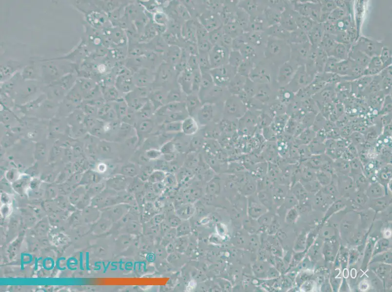 UM-SCC-1 Cell Complete Medium - 5