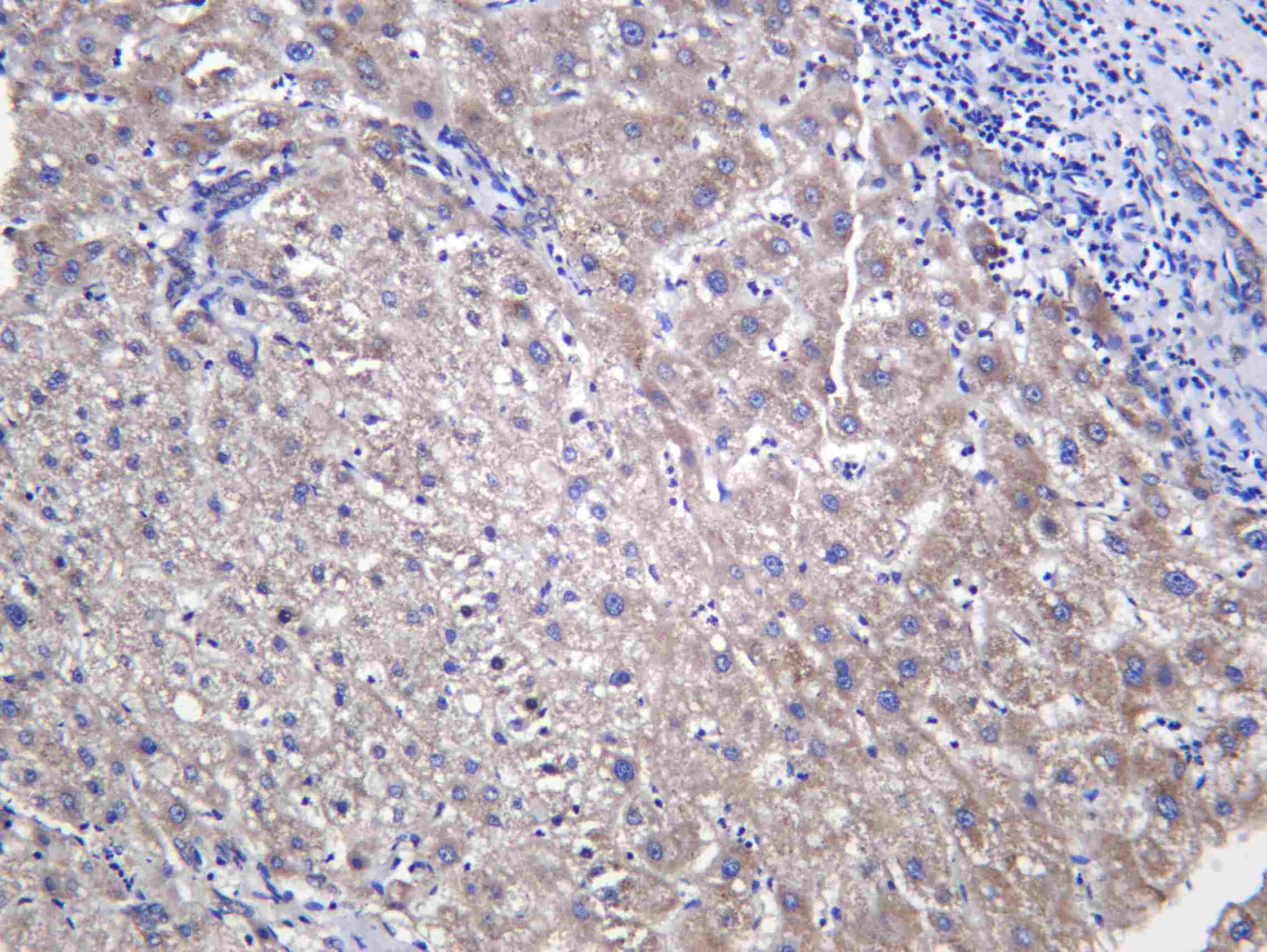 Recombinant BMP 9 Monoclonal Antibody - 1