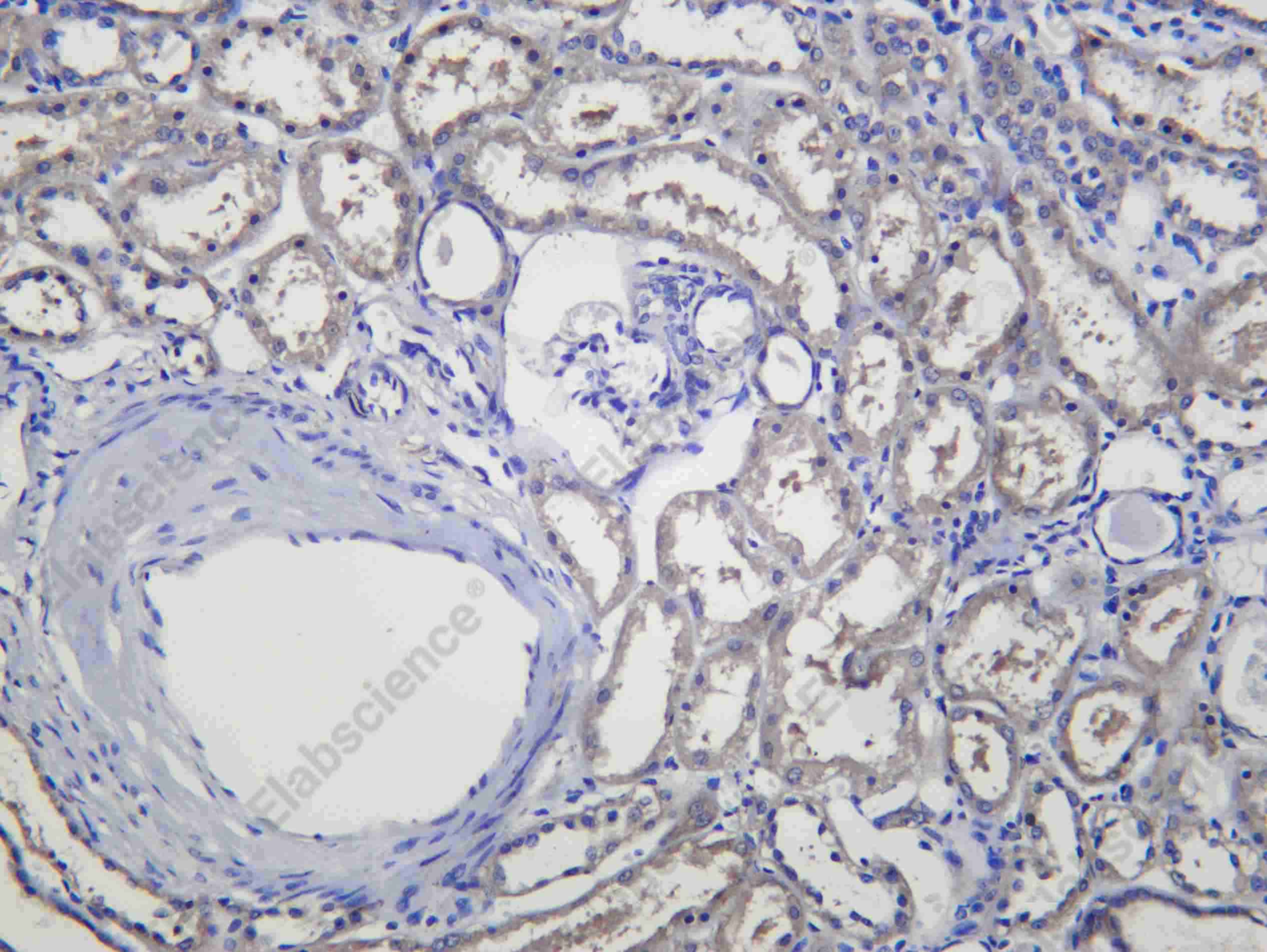 Recombinant Calpain 1 Monoclonal Antibody - 1
