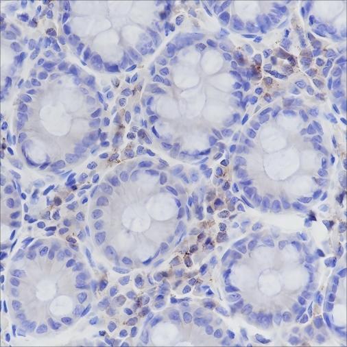 Recombinant CD50/ICAM3 Monoclonal Antibody-searchlist-1