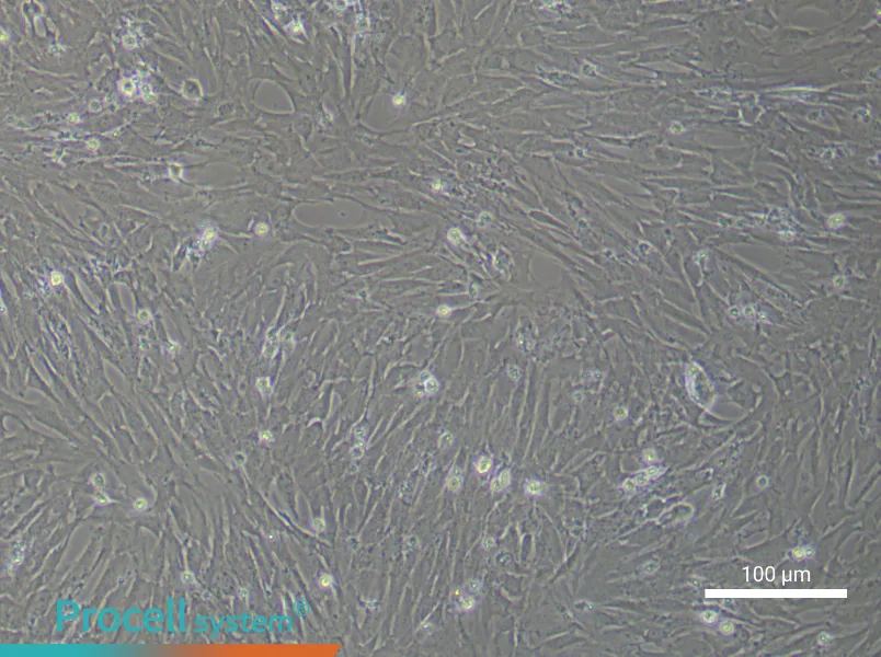 Rat Bladder Fibroblast Complete Medium - 2