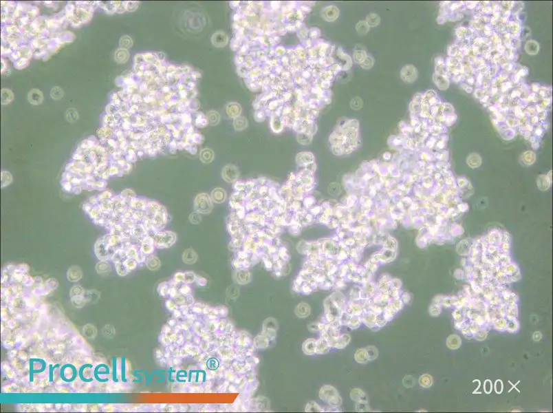NCI-H69 Cell Complete Medium - small - 5