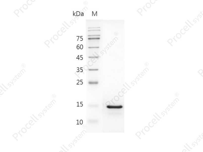 IL-18/IGIF/IL-1g/IL1F4, Human, Recombinant