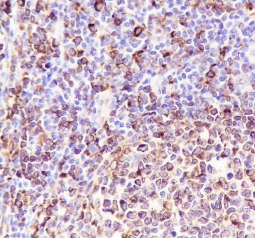 Recombinant CD74 Monoclonal Antibody - 3