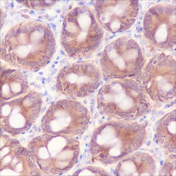 Recombinant MEK2 Monoclonal Antibody - small - 4