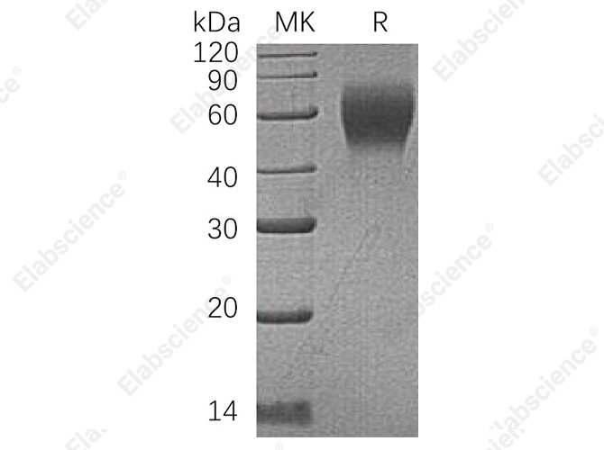 Recombinant Human CD200R1 Protein (His Tag) - 1