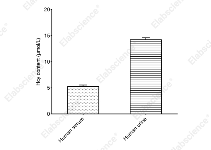 Homocysteine (Hcy) Colorimetric Assay Kit - 1