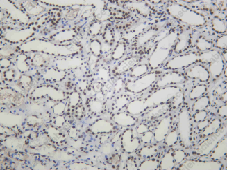 Recombinant Ku-80 Monoclonal Antibody - 2