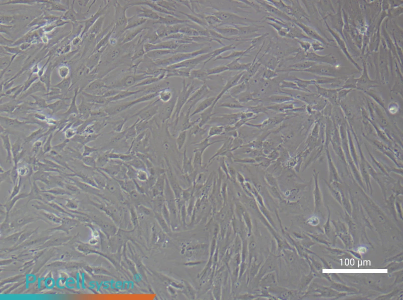 Human Gingival Fibroblast Complete Medium - 3