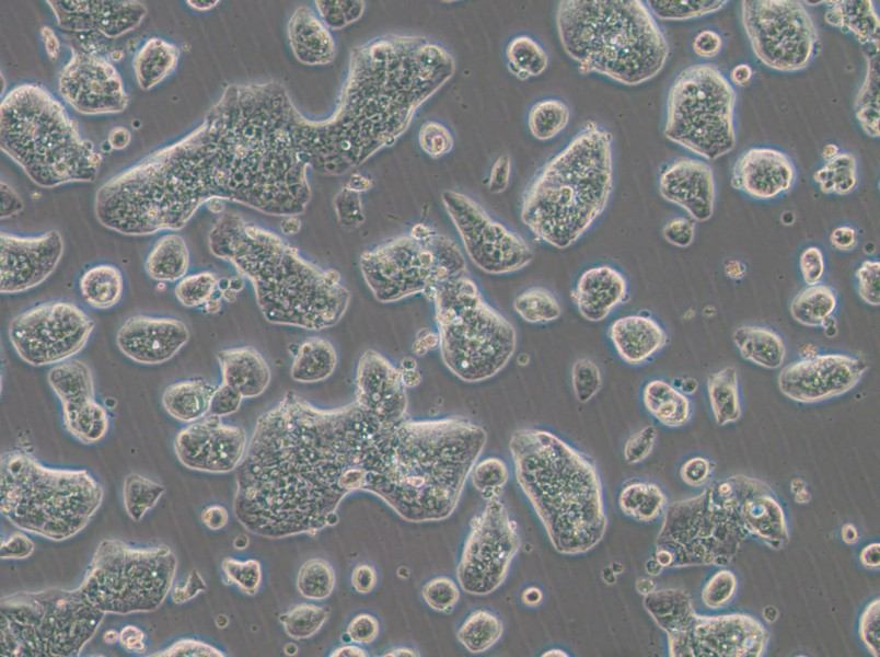 NCI-H1781 Cell Complete Medium - 2