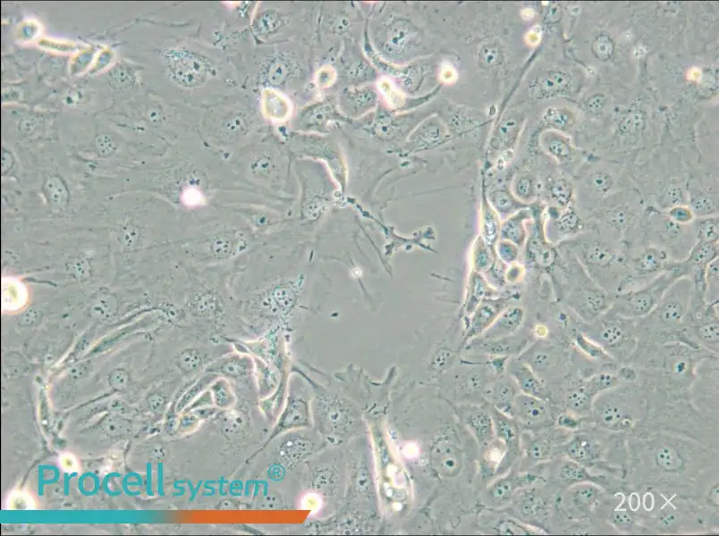 NCI-H2347 Cell Complete Medium - 4