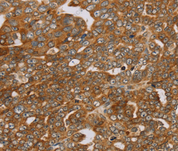 PLEKHG6 Polyclonal Antibody - 3