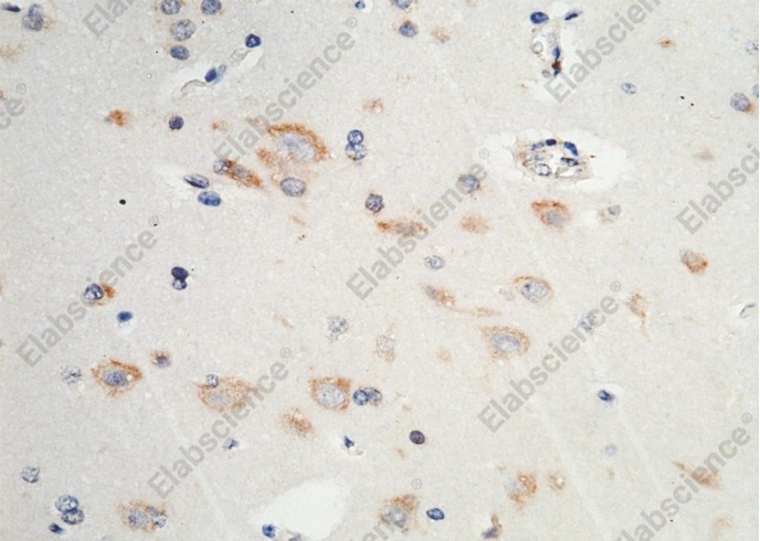 P4HB/ERBA2L Monoclonal Antibody - 3
