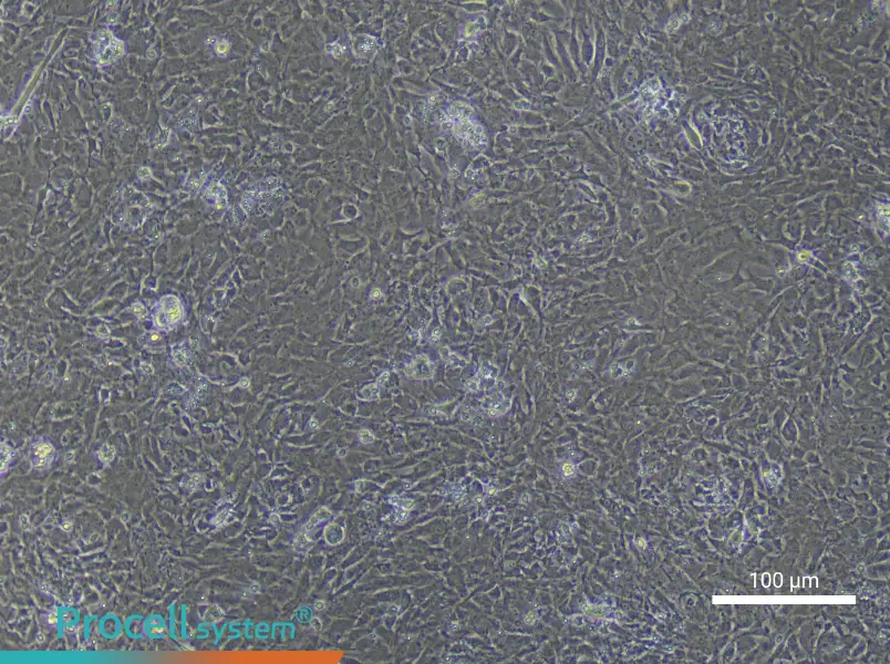 Mouse Trabecular Meshwork Cell Complete Medium - 3