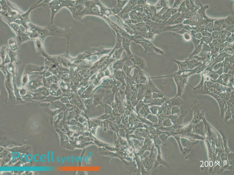 HCC70 Cell Complete Medium - small - 4