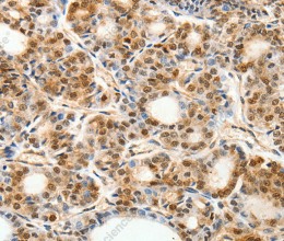 PDCD6 Polyclonal Antibody - 2