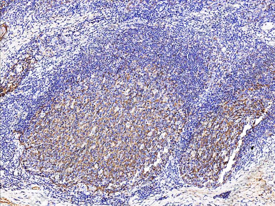 Recombinant Clusterin/Apolipoprotein J/Apo-J Monoclonal Antibody - 2