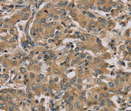 MYL3 Polyclonal Antibody - 3