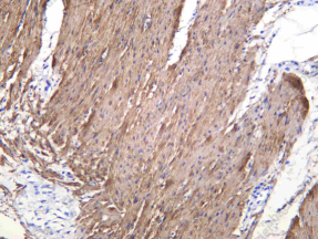 Recombinant Smoothelin Monoclonal Antibody - 1