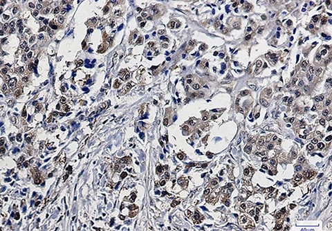 Recombinant GST3 Monoclonal Antibody - 4