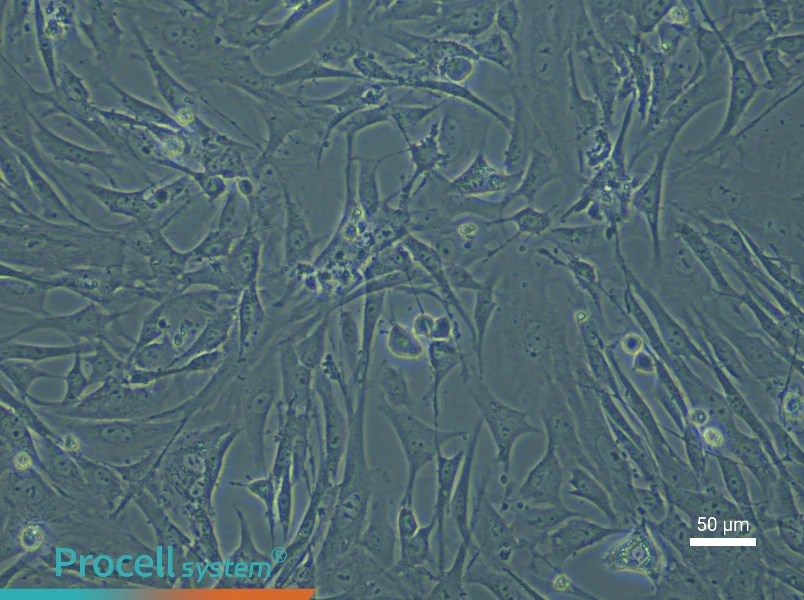 Mouse Vascular Adventitial Fibroblasts - 4