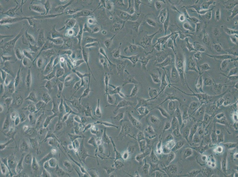 HBE135-E6E7 Cell Complete Medium - 5